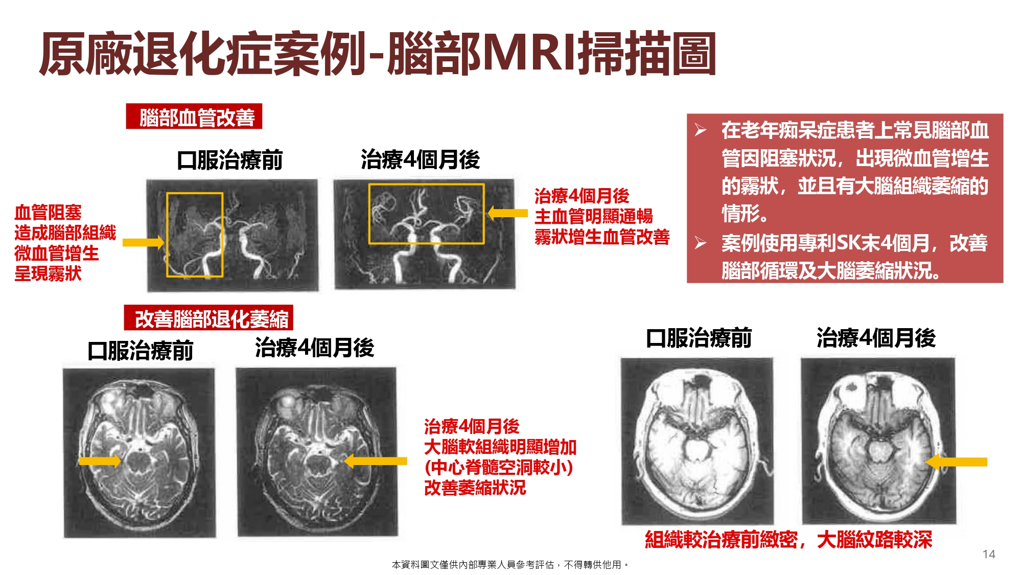 日本專利蚓激酶(20粒):圖片 15